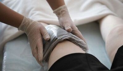 People's methods for the treatment of varicose veins in women