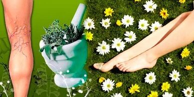 Treatment of varicose veins with folk remedies